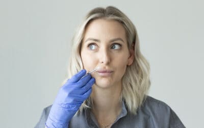 6 Things You Need To Know About Lip Filler